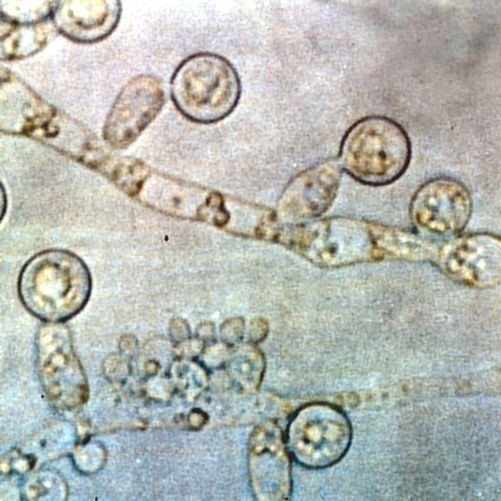 candida albicans essay candida albicans essay